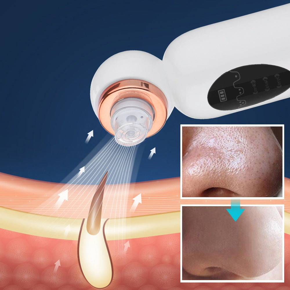 Hydrodermabrasion Mitesserentferner