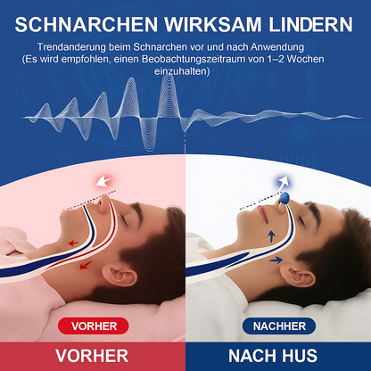 Tragbares Antischnarchgerät für besseren Schlaf & freie Atmung